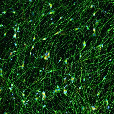 Quick-Neuron™ Excitatory - Human iPSC-derived Neurons (M, 68 yr donor) - Alzheimer's Disease