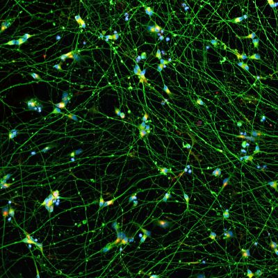 Quick-Neuron™ Excitatory - Human iPSC-derived Neurons (F, 6 yr donor) - Epilepsy