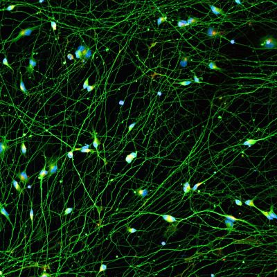 Quick-Neuron™ Excitatory - Human iPSC-derived Neurons (M, 36 yr donor) - Fatty Liver Disease