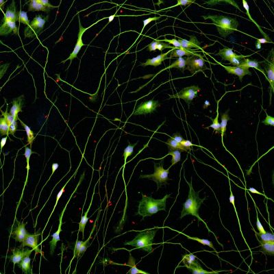 Quick-Neuron™ Cholinergic - Human iPSC-derived Neurons Healthy Control - (F, 21yr, Asian)