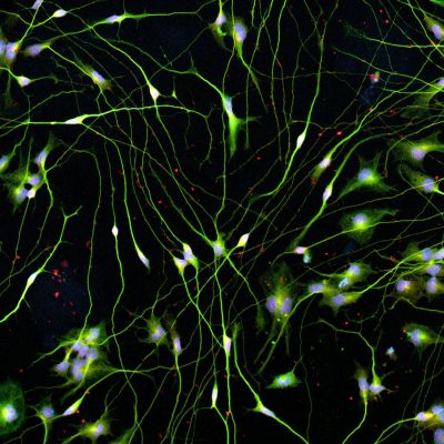Quick-Neuron™ Cholinergic - Human iPSC-derived Neurons Healthy Control - (F, 74yr, Caucasian, not Latino)