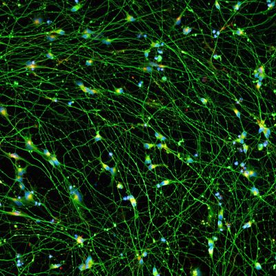 Quick-Neuron™ Excitatory - Human iPSC-derived Neurons Healthy Control - (M, 38yr, Asian)