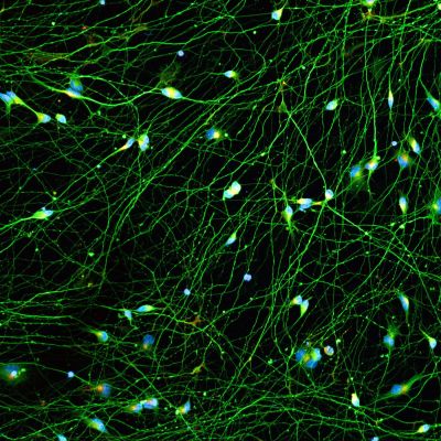 Quick-Neuron™ Excitatory - Human iPSC-derived Neurons (F, 74 yr donor) - Healthy Control