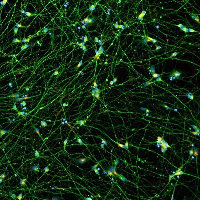 Quick-Neuron™ Excitatory - Human iPSC-derived Neurons (F, 18 yr donor) - Autism Spectrum Disorder