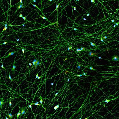 Quick-Neuron™ Excitatory - Human iPSC-derived Neurons (F, 21 yr donor) - Healthy Control