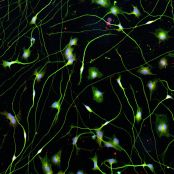 Quick-Neuron™ Cholinergic - Human iPSC-derived Neurons Alzheimer's Disease - (F, 72yr, Caucasian, not Latino)