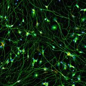 Quick-Neuron™ Excitatory - Human iPSC-derived Neurons Healthy Control - (M, 69yr, Caucasian, not Latino)