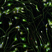 Quick-Neuron™ Cholinergic - Human iPSC-derived Neurons Healthy Control - (M, 69yr, Caucasian, not Latino)