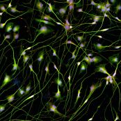 Quick-Neuron™ Cholinergic - Human iPSC-derived Neurons Alzheimer's Disease - (M, 68yr, Caucasian, not Latino)