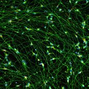 Quick-Neuron™ Excitatory - Human iPSC-derived Neurons Healthy Control - (M, 38yr, Asian)