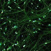 Quick-Neuron™ Excitatory - Human iPSC-derived Neurons Healthy Control - (F, 21yr, Asian)