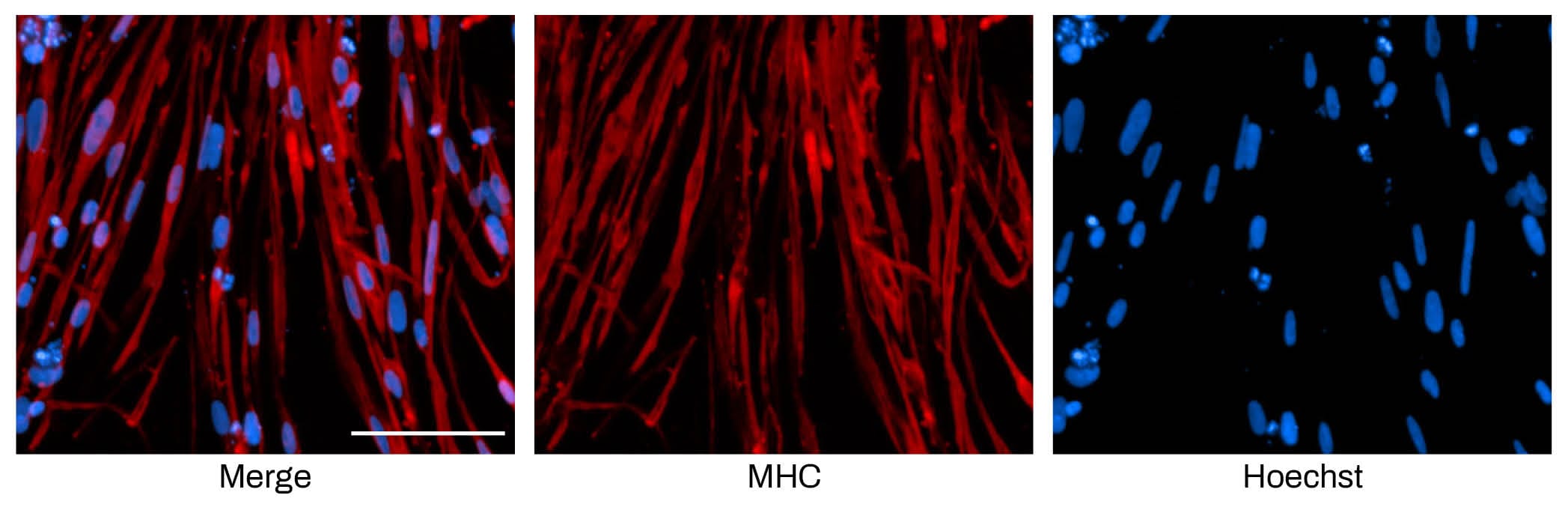Immunofluorescent staining of Skeletal - mRNA cell cultures on day 6 post-differentiation