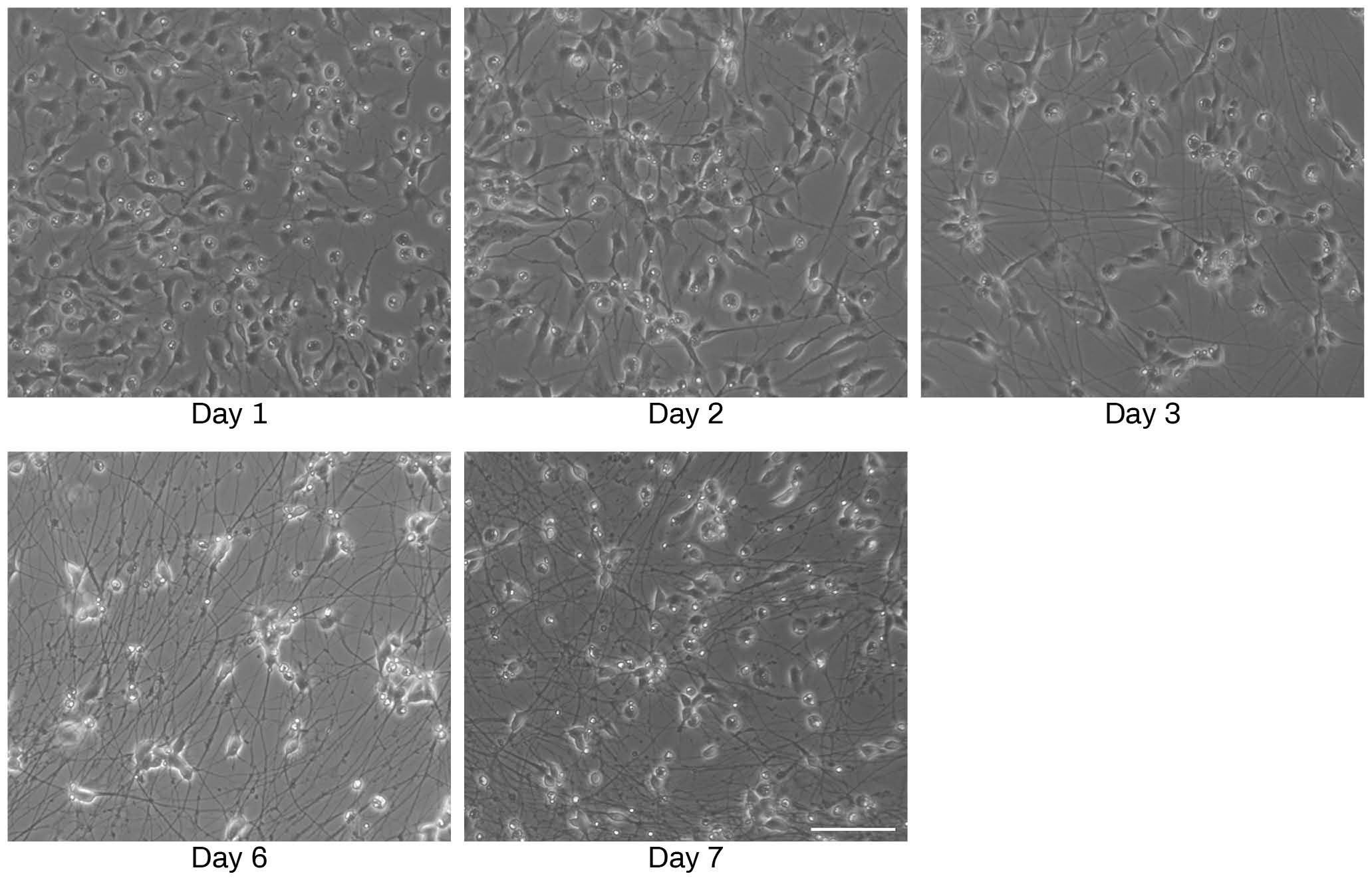 Microscope images of iPSC-derived Neuron differentiation over 7 days